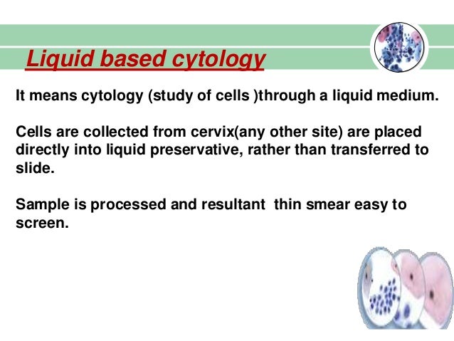 Liquid cytology - what is it Liquid cytology of the cervix: interpretation of the results, reviews Liquid cytology - what is it Liquid cytology of the cervix: interpretation of the results, reviews